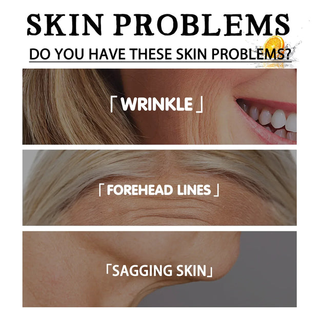 Anti Wri-nkle Cream Snail Serum Face Moisturizer