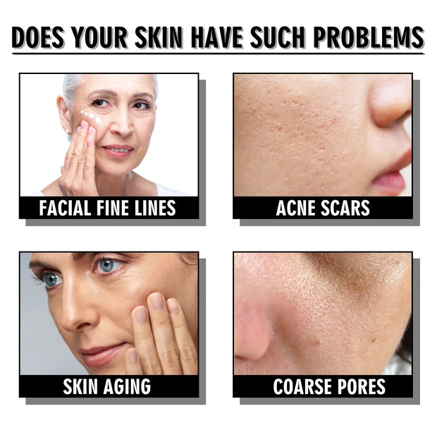 Anti Wri-nkle Cream Snail Serum Face Moisturizer